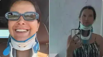 Kaza Sonrası İlk Görüntü: İrem Helvacıoğlu Düğüne Boyunlukla Katıldı